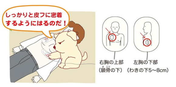 JapanDefibrilatorErklärung